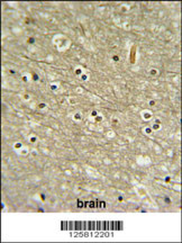 WDR82 Antibody (N-term)