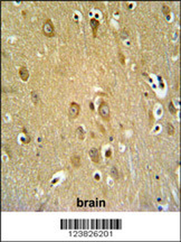 SYTL2 Antibody (Center)
