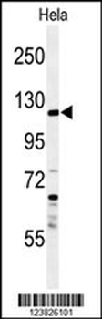SYTL2 Antibody (Center)