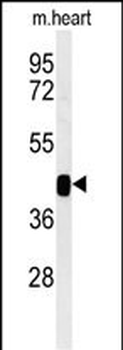B3GNT7 Antibody (Center)