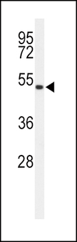 ASMT Antibody (Center)