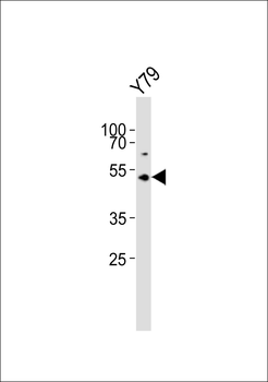 ASMT Antibody (Center)