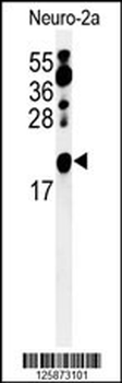 ZNF9 Antibody (Center)