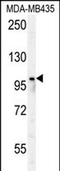 PARP8 Antibody (Center)