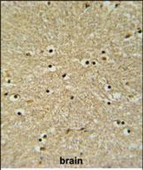 BHLHB5 Antibody (Center)