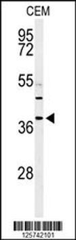 RNASEH2B Antibody (Center)