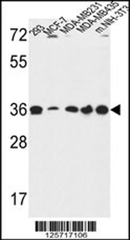 TOR1B Antibody (Center)