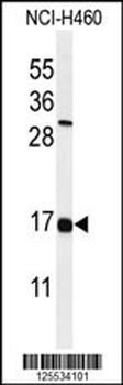 IFM2 Antibody (N-term)
