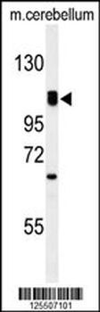 G7C Antibody (N-term)