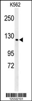 CQ068 Antibody (Center)
