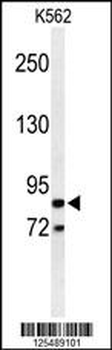 AVIL Antibody (N-term)