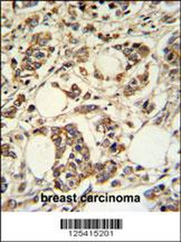 PIGM Antibody (C-term)