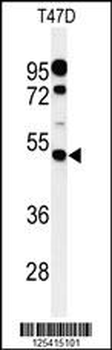 PIGM Antibody (C-term)