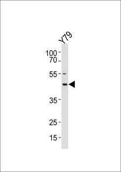 RDH10 Antibody (Center)