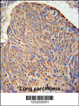 CC130 Antibody (Center)