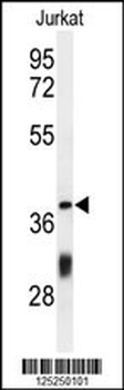 CC130 Antibody (Center)