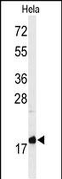MMGT1 Antibody (C-term)