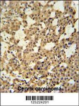 CJ119 Antibody (N-term)