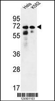 PNPLA8 Antibody (N-term)