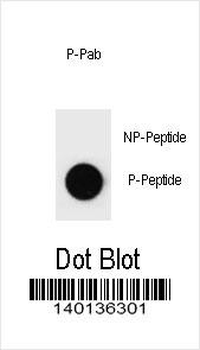 Phospho-rat PARP1(S373) Antibody