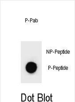 Phospho-PARP1(S41) Antibody