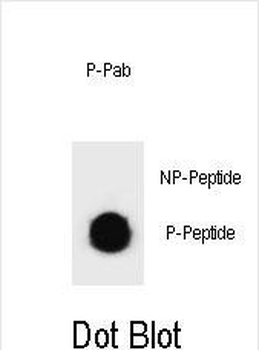 Phospho-KIT(Y570) Antibody