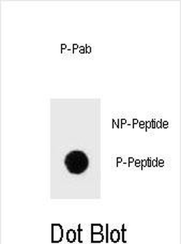 Phospho-IKKB(S675) Antibody