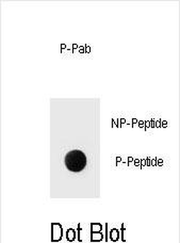 Phospho-ERBB2(Y1139) Antibody