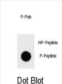Phospho-ERBB2(Y1127) Antibody
