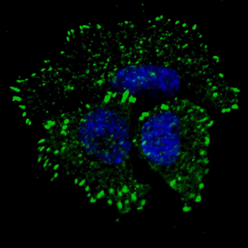 Phospho-ERBB2(Y1127) Antibody