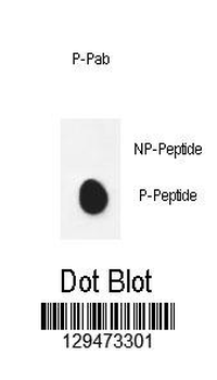 Phospho-PDHE1A(S232) Antibody