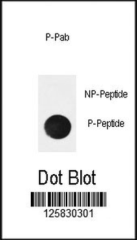 Phospho-NFKBIA(Ser32)) Antibody