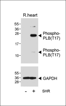Phospho-PLB(T17) Antibody