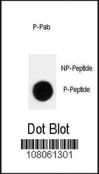 Phospho-p27Kip1(T198) Antibody