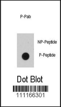 Phospho-EGFR(Y1016) Antibody