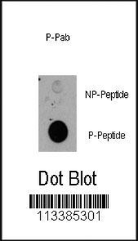 Phospho-RPS6KA1(T359) Antibody