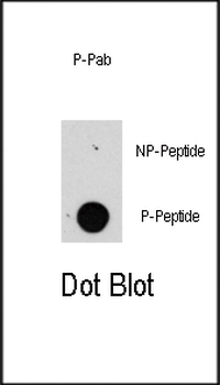 Phospho-Raptor(S863) Antibody