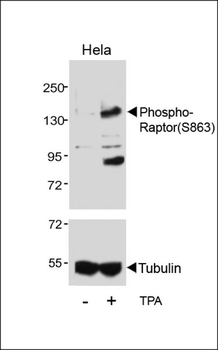Phospho-Raptor(S863) Antibody
