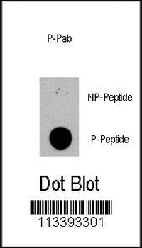 Phospho-TSC2(S1420) Antibody