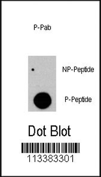 Phospho-RAF1(Y341) Antibody