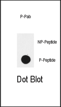 Phospho-EGFR(Y1172) Antibody