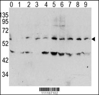 Phospho-MYC(T58) Antibody