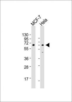 S6K (RPS6KB1) Antibody (S424)