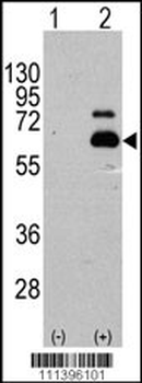 S6K (RPS6KB1) Antibody (S404)