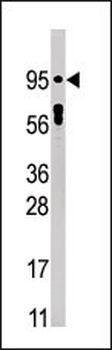 Phospho-STAT5a(Y694) Antibody