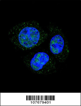 Phospho-Rb(S811) Antibody