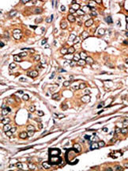 Phospho-Rb(S780) Antibody