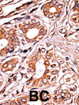 Phospho-Rb(S249) Antibody