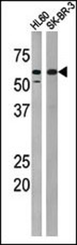 Phospho-MYT1(T495) Antibody