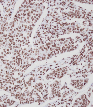 Phospho-HER4(Y1188) Antibody